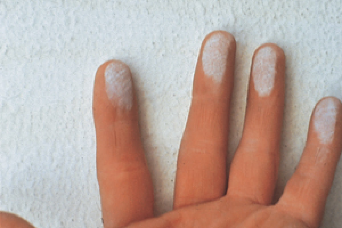Chalking - powdery residue caused by weathering